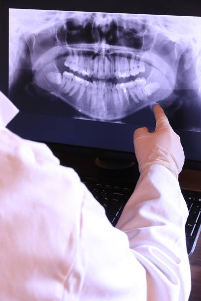Best Emergency Treatment for Dental Infections or Abscesses in Lake Delta, NY